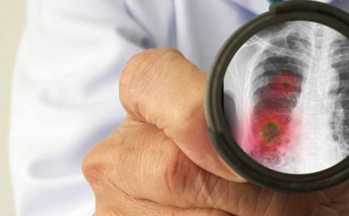 3BB6F7BD-AA86-45E8-A432-7D23A649DDF3